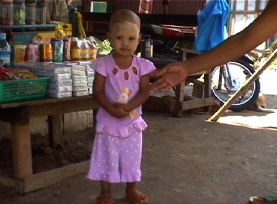 TaungKalatNoennchen